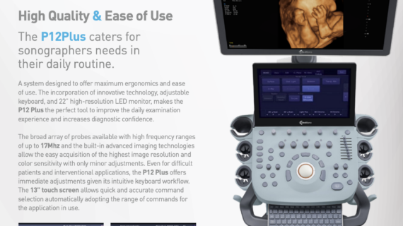 P12 PLUS Digital Color Doppler Ultrasound System