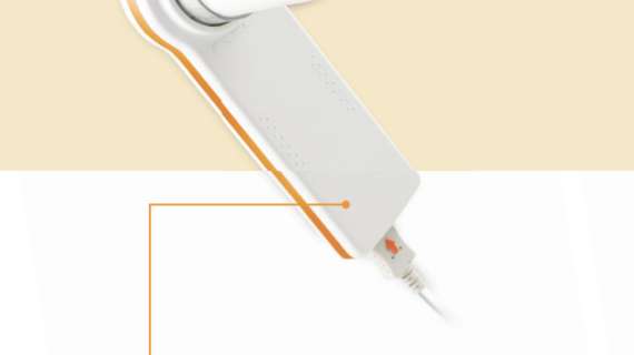 Minispiro Spirometer