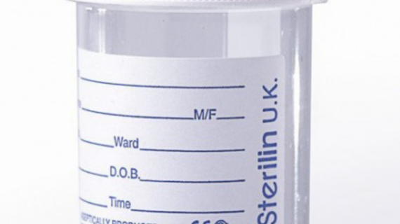 Urine Container, 60ml
