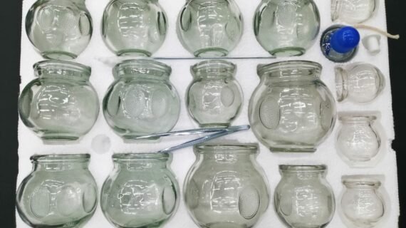 Hijama Cupping Set
